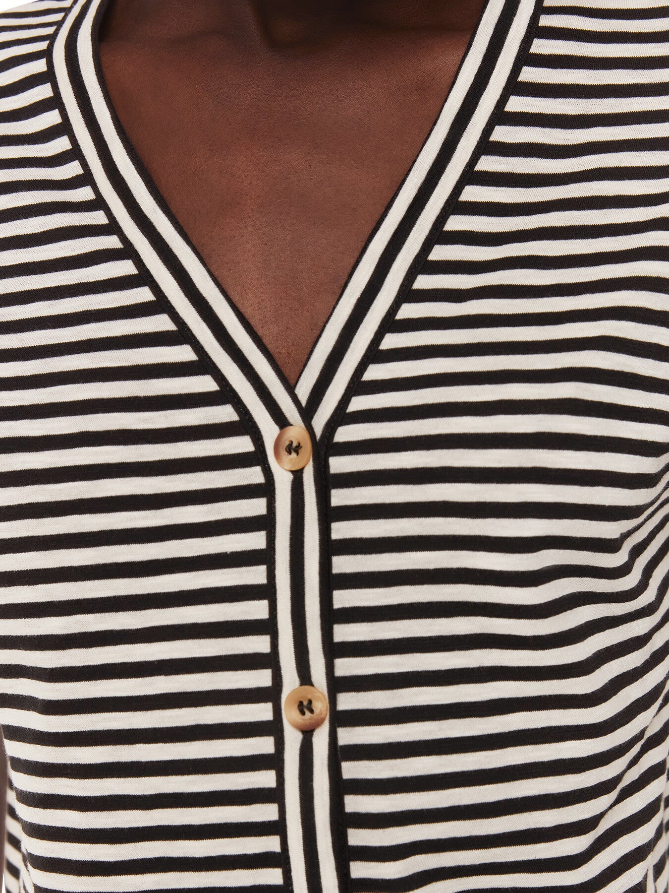 Jilly Stripe Button Top