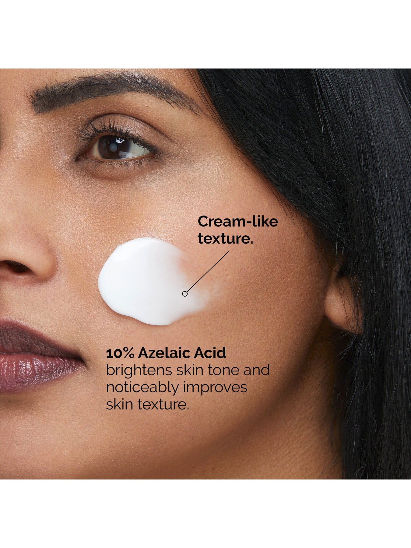 Azelaic Acid Suspension 10