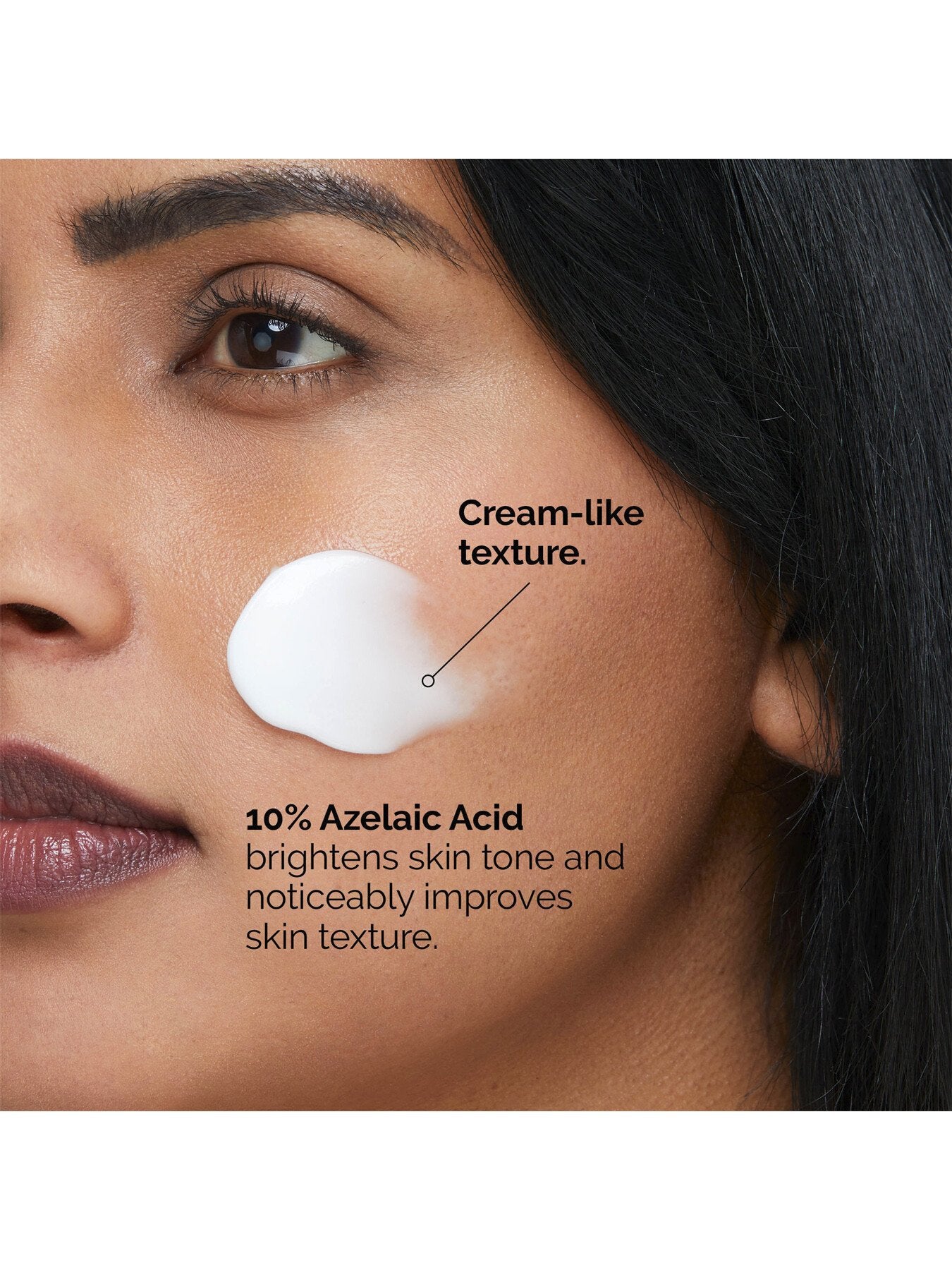 Azelaic Acid Suspension 10 100ml