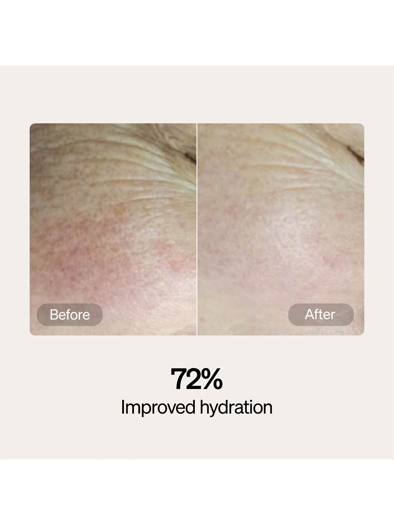 Lyma Skincare Serum And Cream Starter Kit