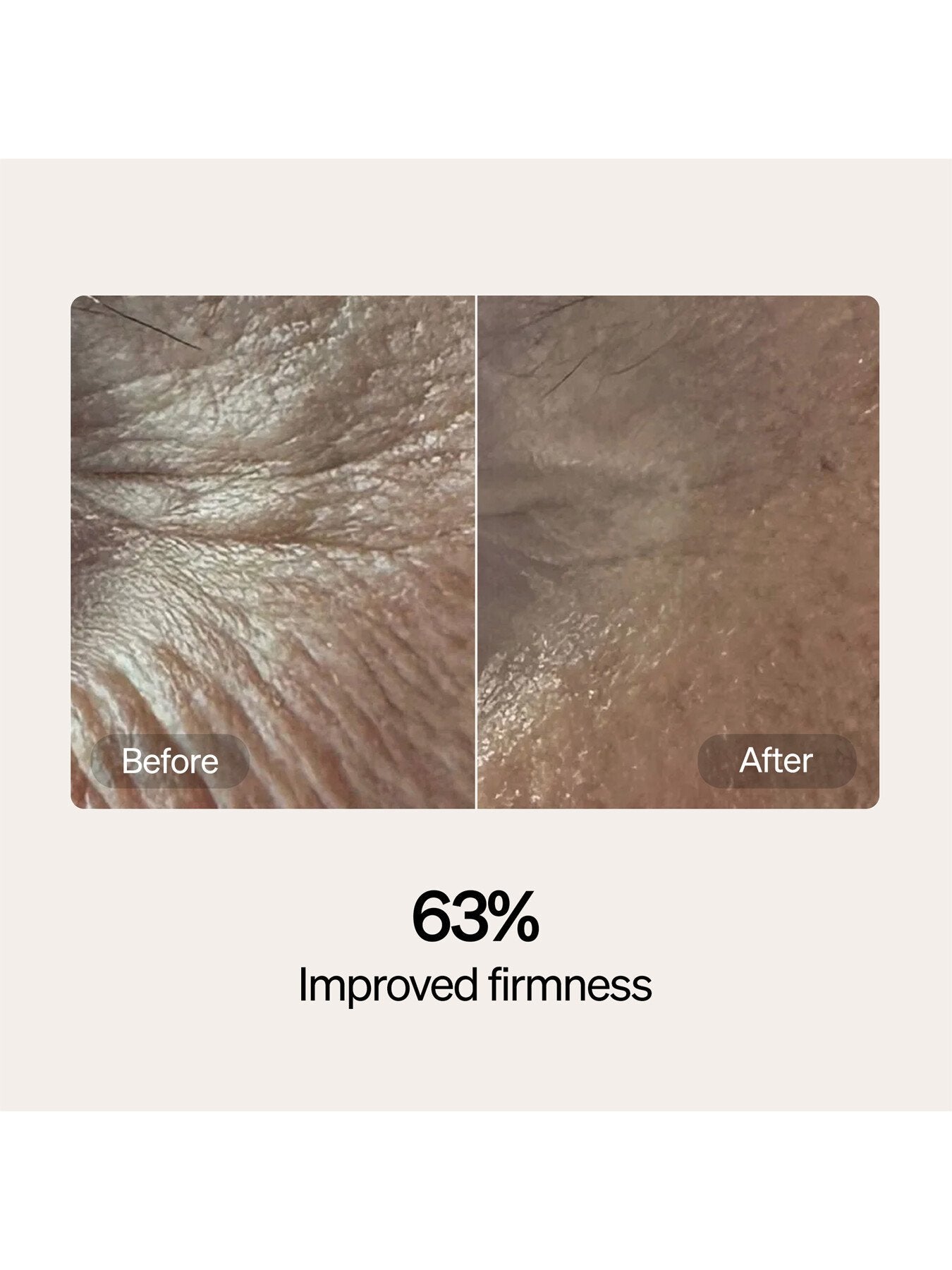 Lyma Skincare Serum And Cream Starter Kit