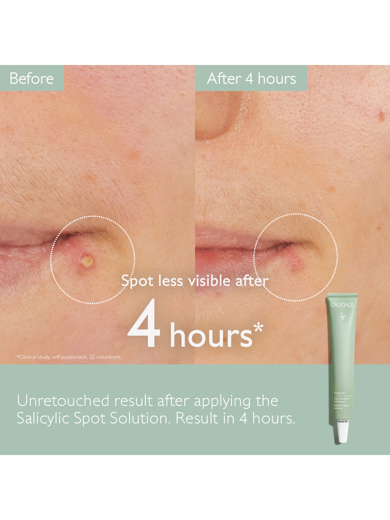 Vinopure Salicylic Spot Solution 15ml