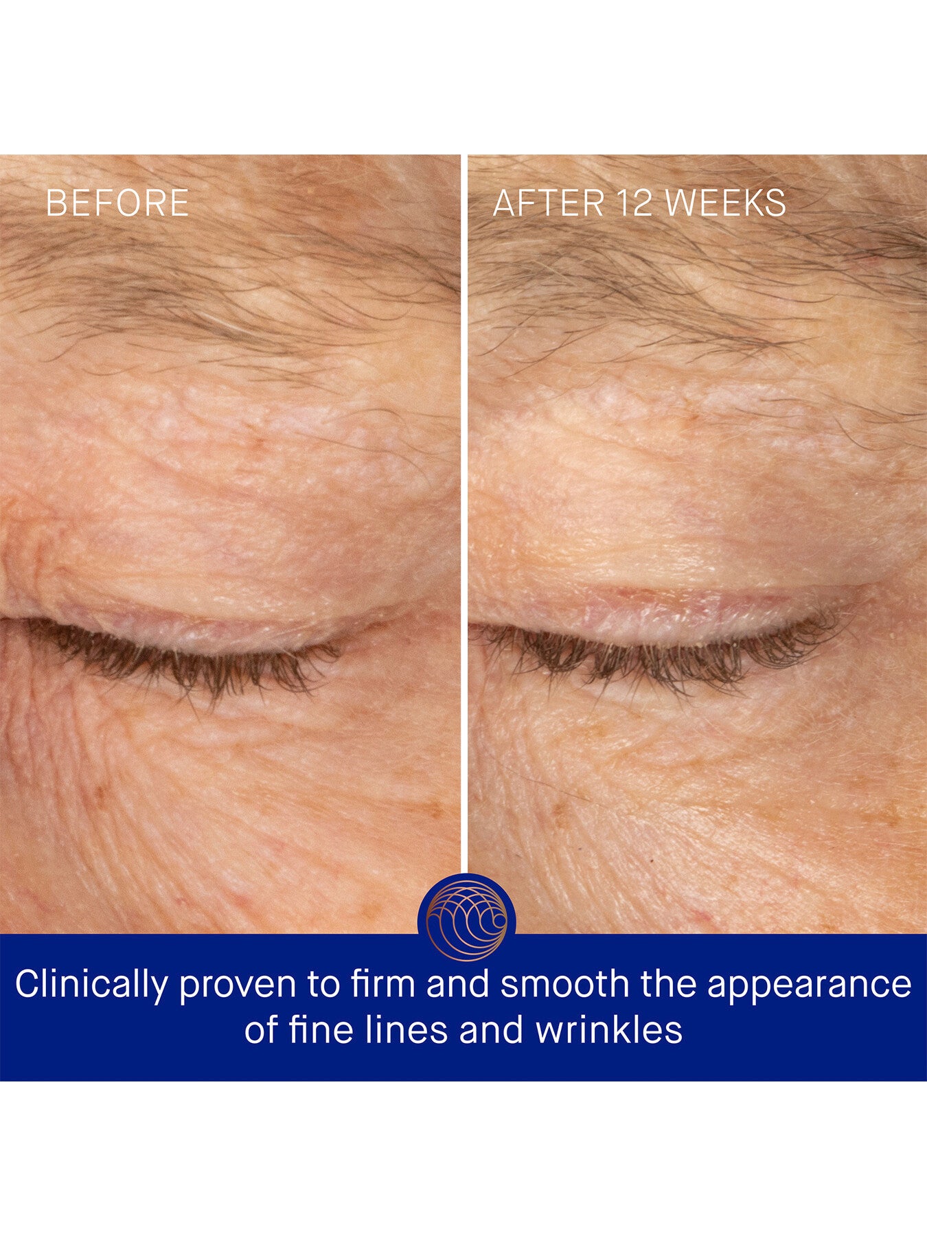 The Rich Eye Cream