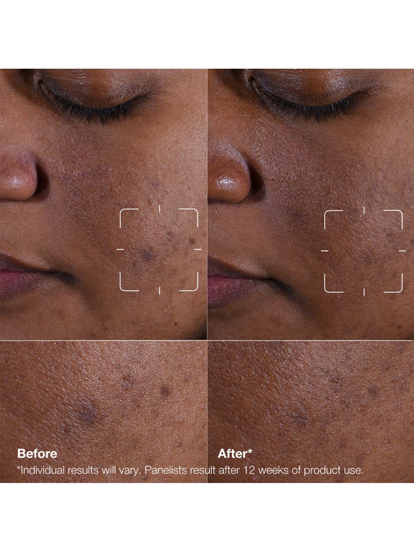 Even Better Clinical™ Dark Spot Clearing Serum 30ml