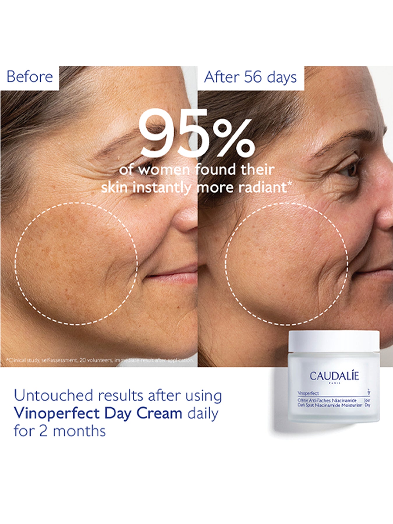 Caudalie Vinoperfect Dark Spot Niacinamide Moisturiser 50ml