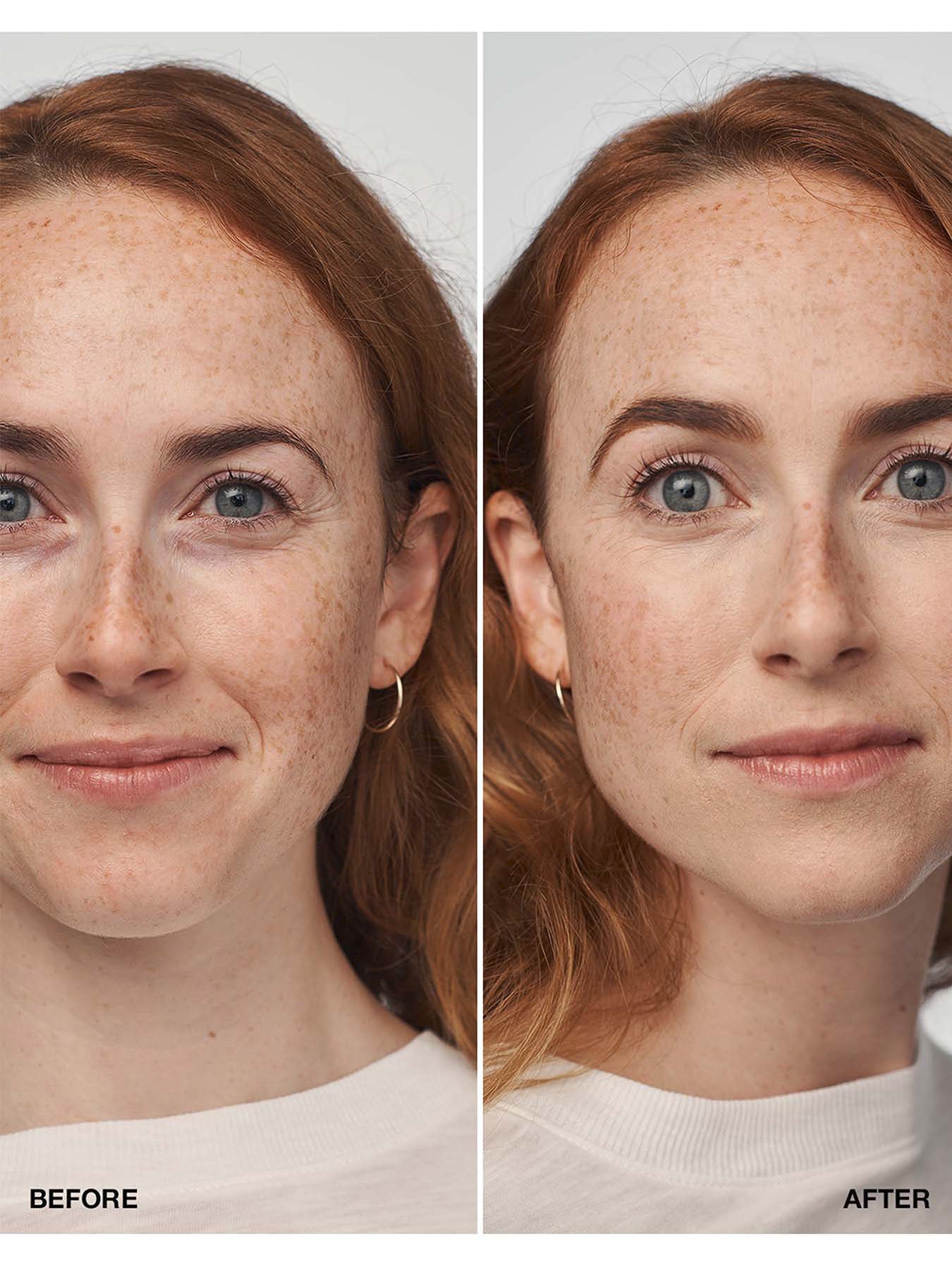 Even Better Clinical™ Serum Foundation SPF20