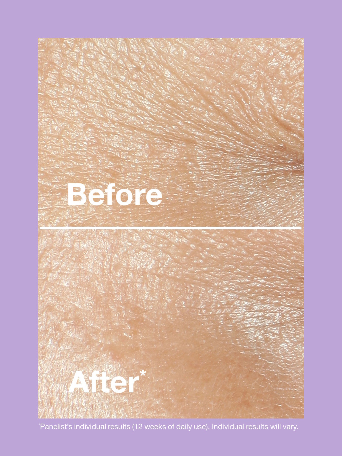 Smart Clinical Repair Wrinkle Cream Rich 50ml
