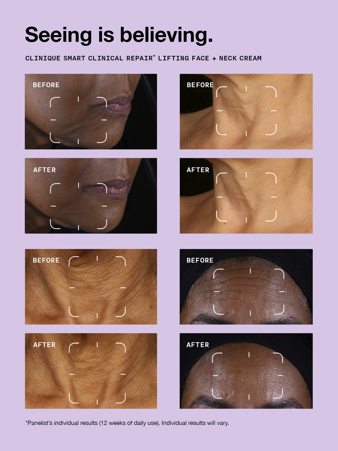 Clinique Smart Clinical Repair™ Lifting Face Neck Cream