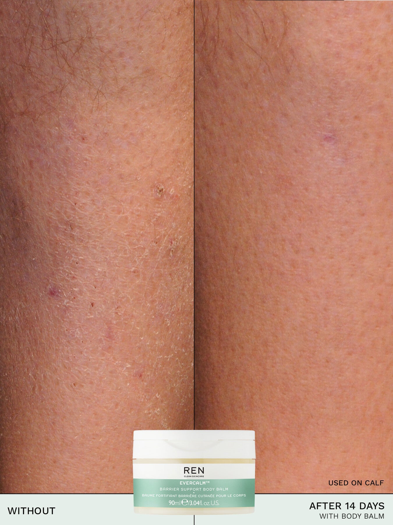 Evercalm™ Barrier Support Body Balm