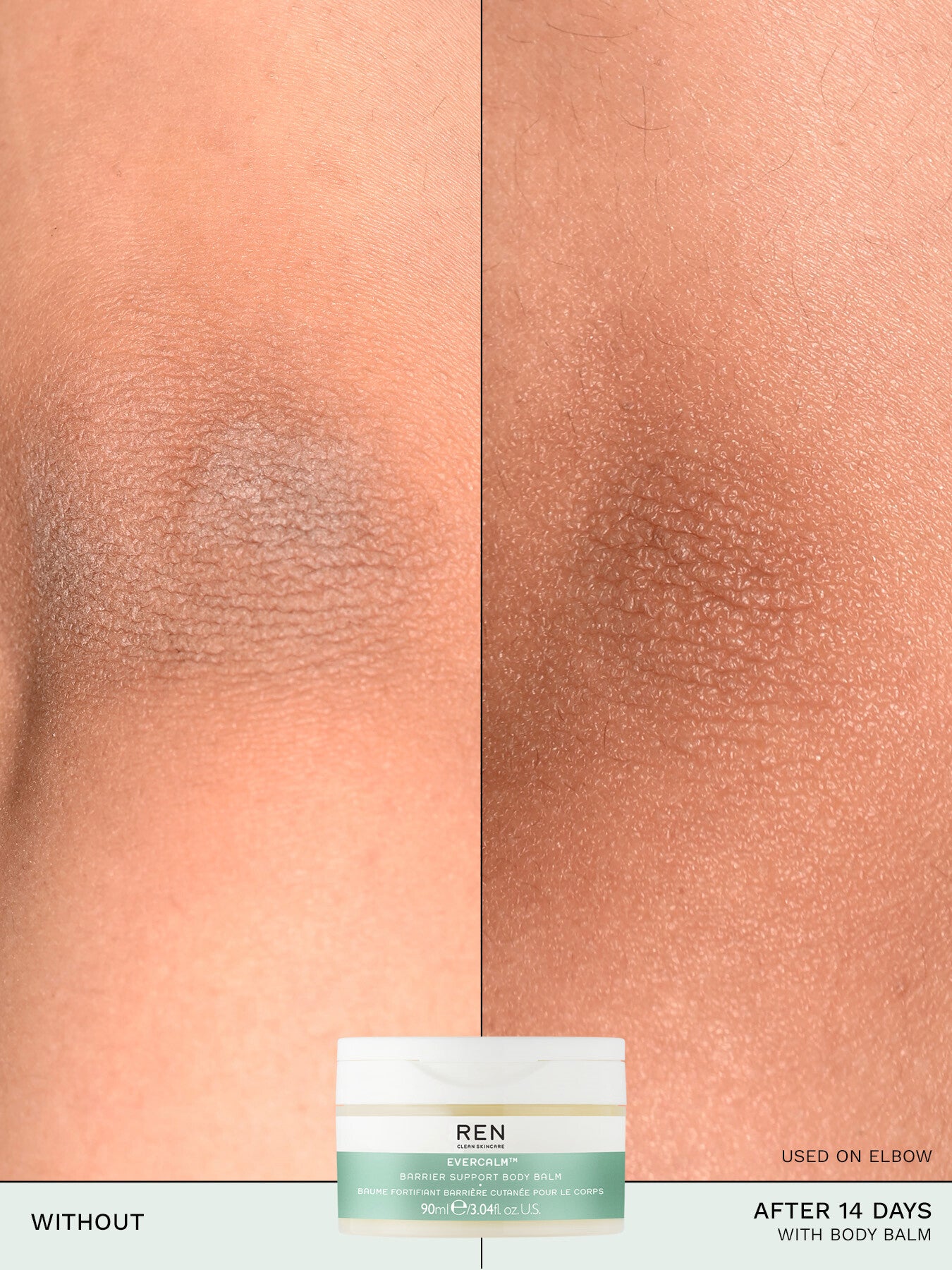 Evercalm™ Barrier Support Body Balm