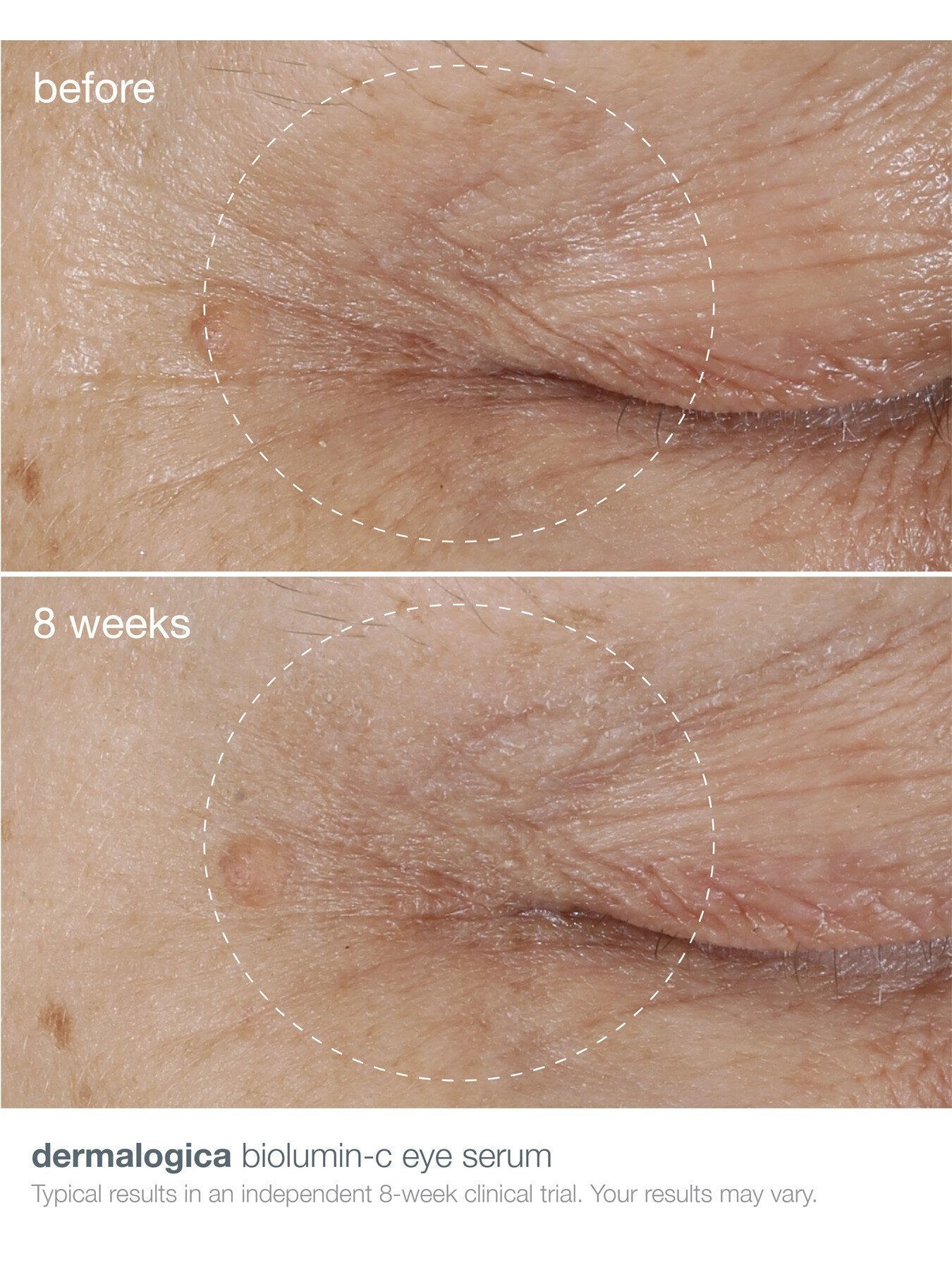 BioLumin-C Eye Serum