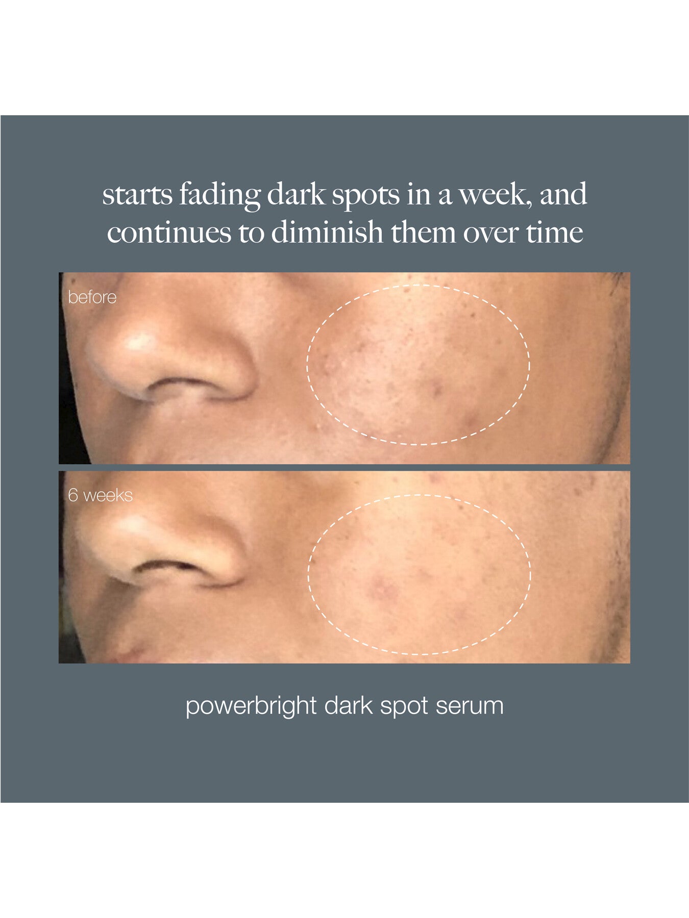 Powerbright Dark Spot Serum