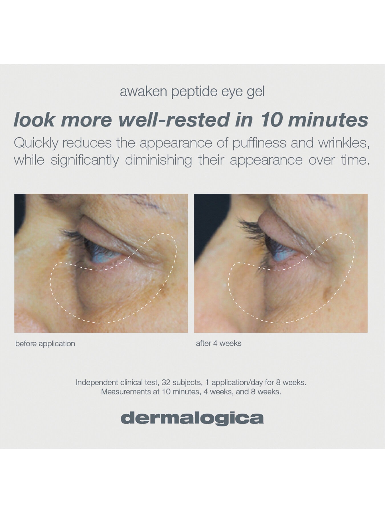 Awaken Peptide Eye 15ml