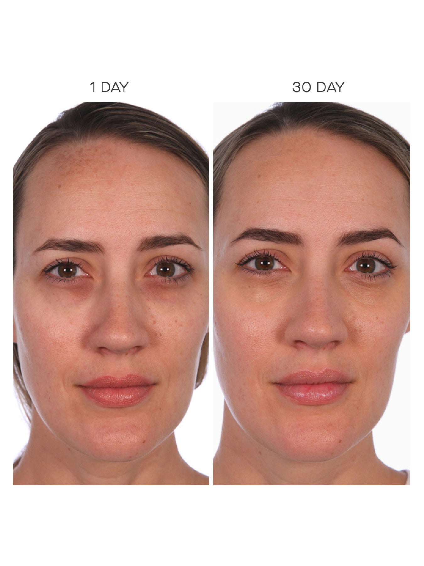 Resurfacing Compound 30 ml