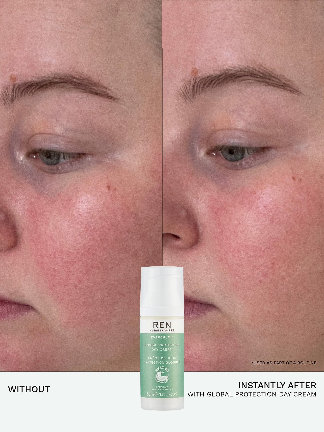 Evercalm™ Global Protection Day Cream