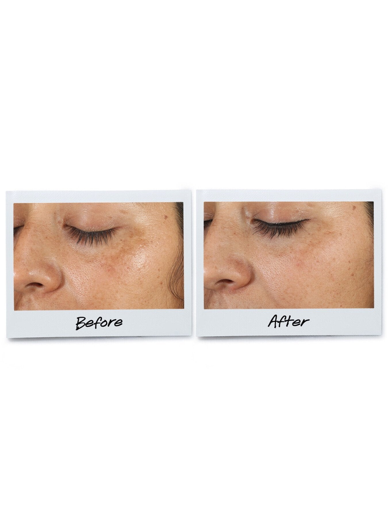 Kiehls Clearly Corrective™ Dark Spot Solution