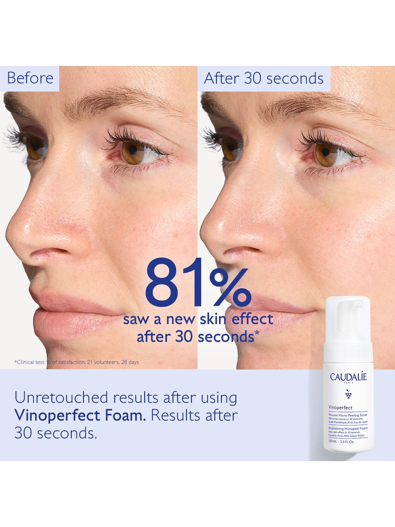 Vinoperfect Brightening Micropeel Foam 100ml