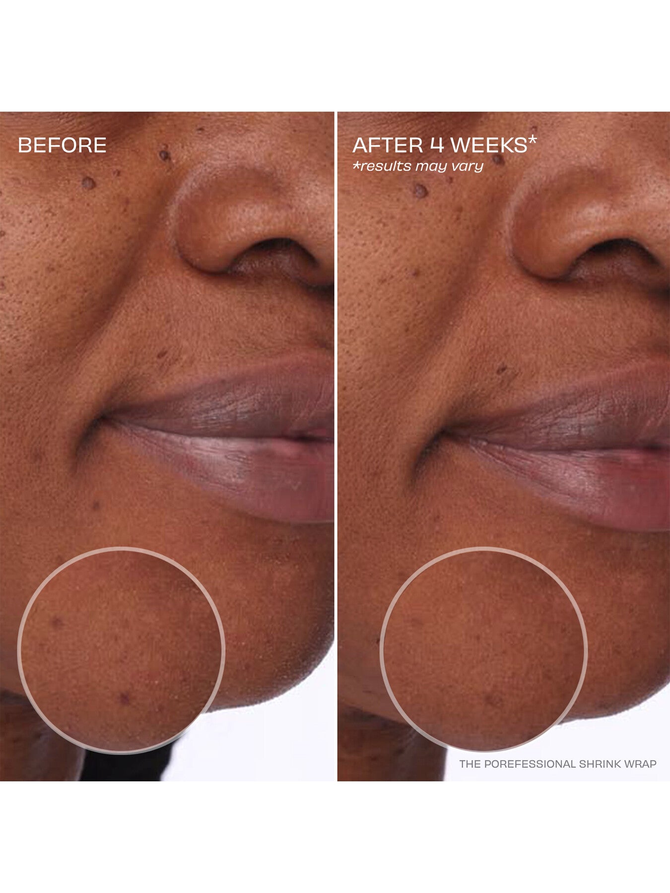 The Porefessional Shrink Wrap
