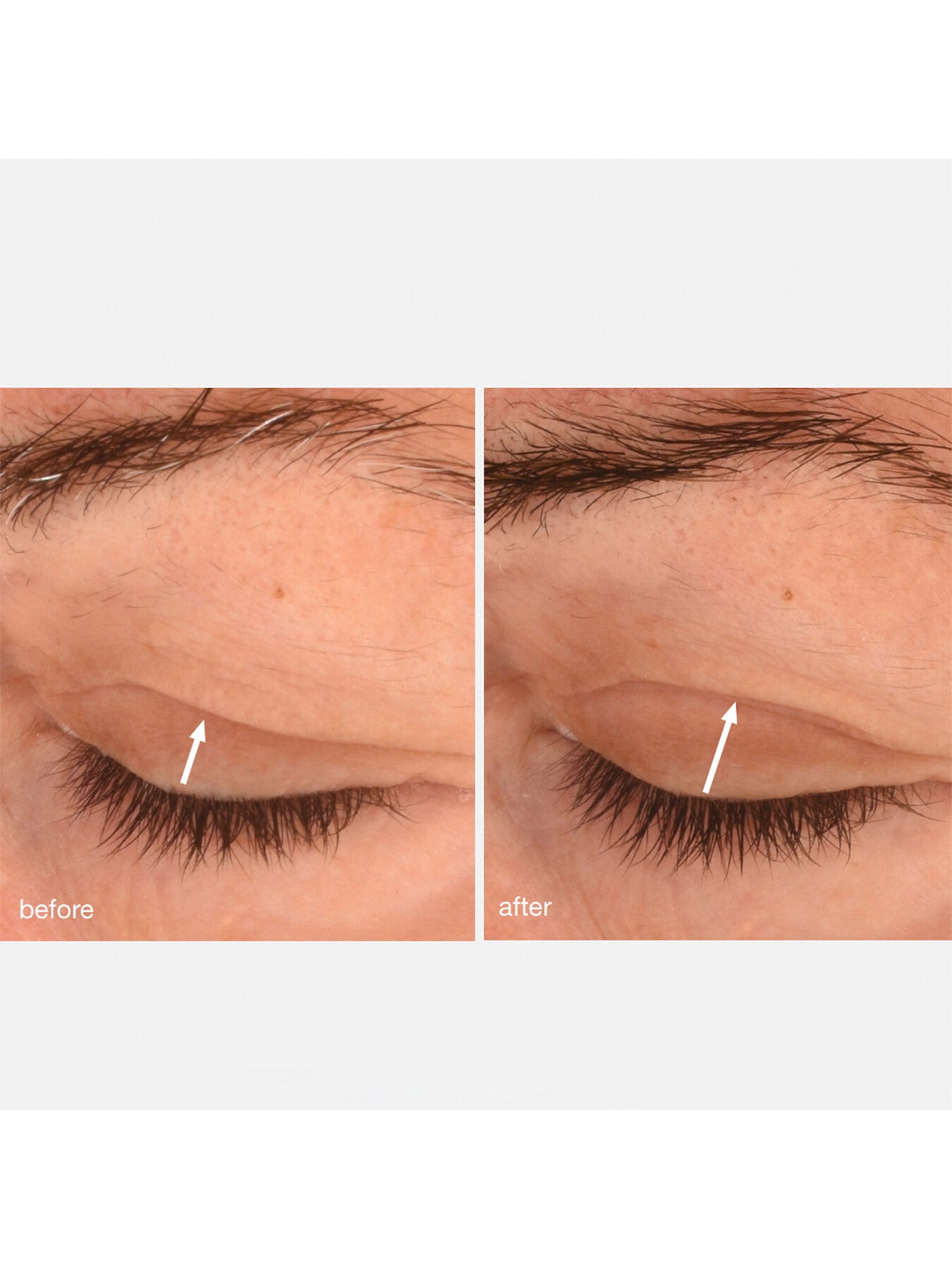 Phyto Nature Lifting 15ml Eye Cream