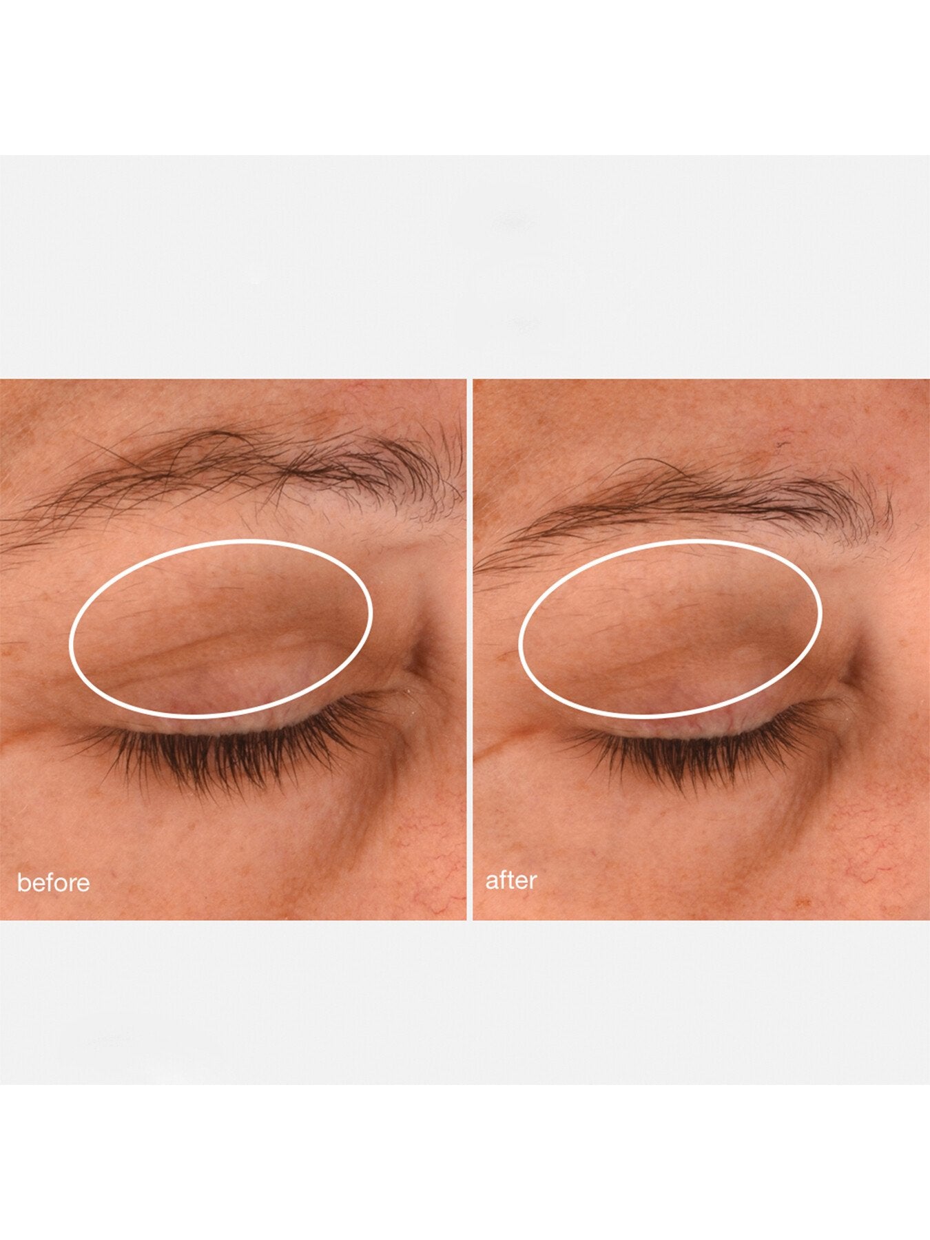 Phyto Nature Lifting 15ml Eye Cream