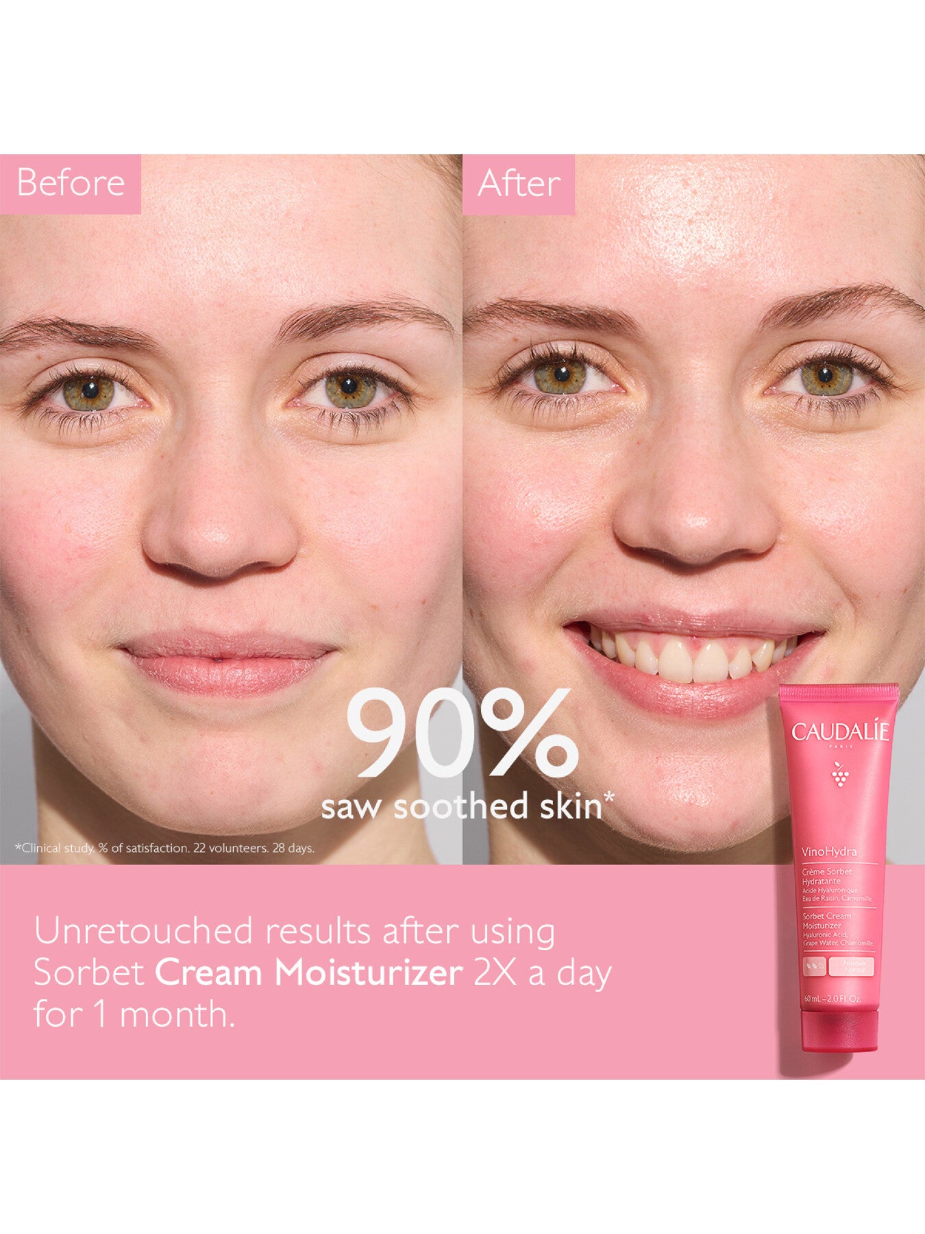 VinoHydra Sorbet Cream Moisturizer 60ml