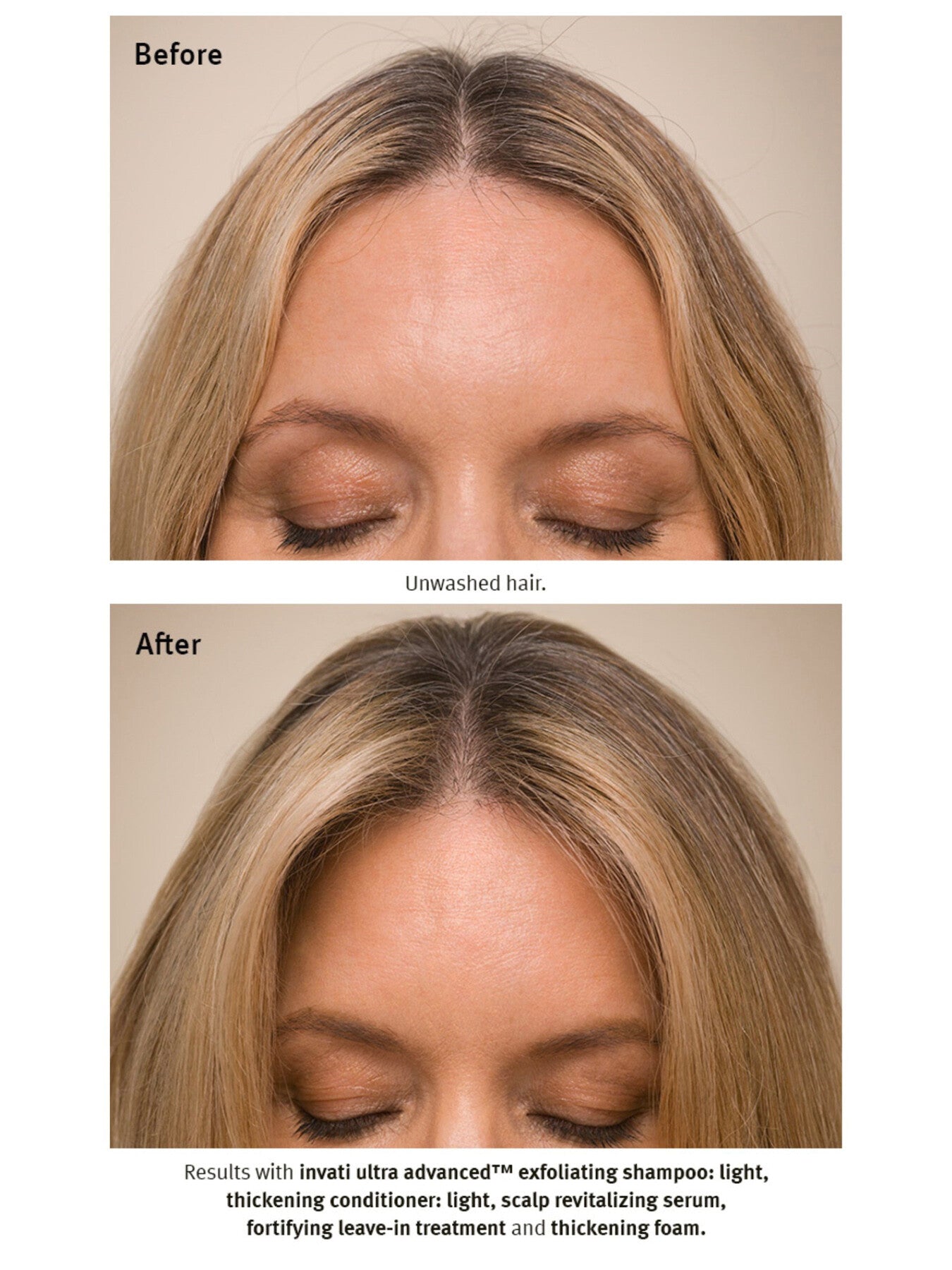 Invati Ultra Advanced™ Thickening Conditioner Light 40ml