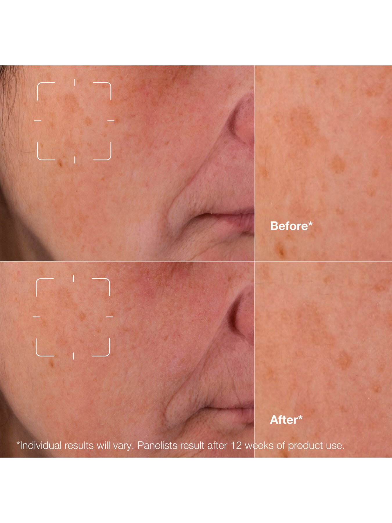 Even Better Clinical™ Dark Spot Clearing Serum 30ml