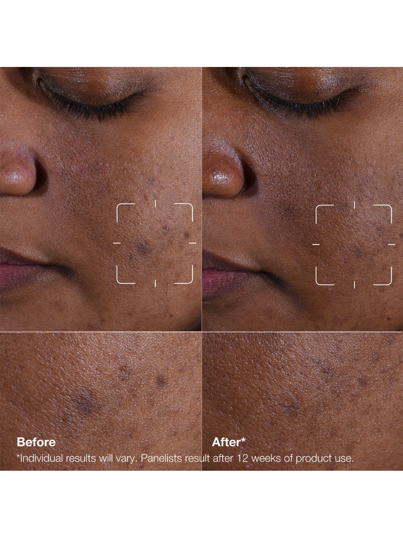 Even Better Clinical™ Dark Spot Clearing Serum 50ml
