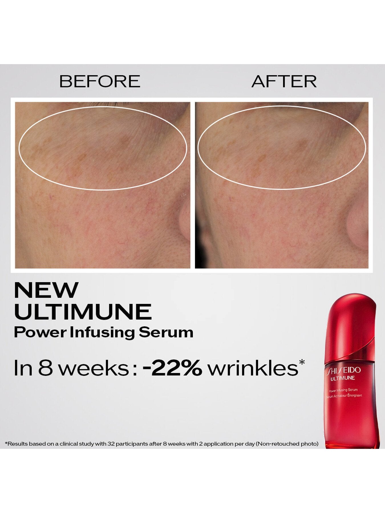 Ultimune Power Infusing Serum 75ml